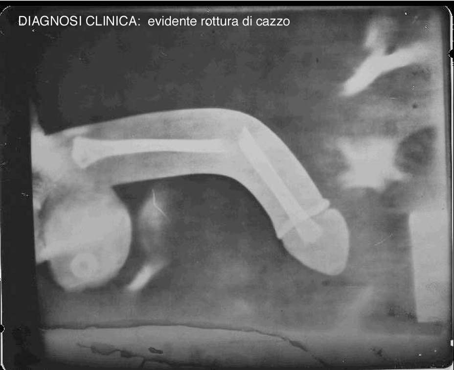 Original Photo Broken Penis - PhuckedTube.